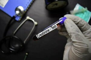 Czy kreatynina jest szkodliwa dla zdrowia?